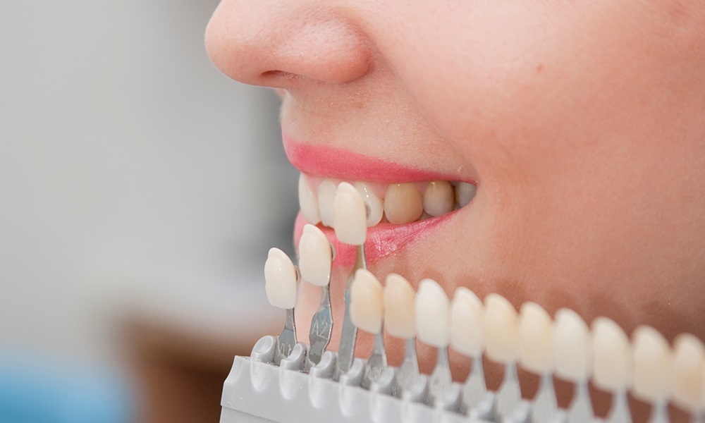 Facetas